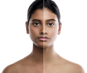 From Dull to Dazzling Skin Whitening That Works