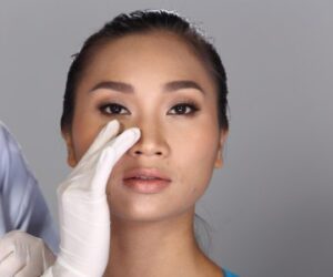 Is Rhinoplasty a Good Option for Smoothing Nose Humps?