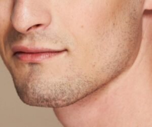 Is Male Jawline Filler Different in Method?