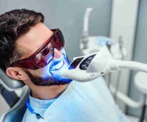 Laser Activation: Breaks Down Stains for a Brighter Smile