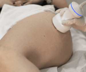 Non-Surgical Bum Lift Techniques for a Natural Look