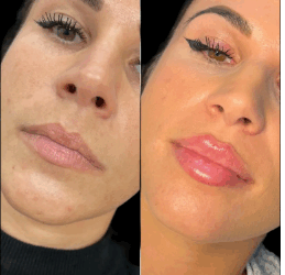 Best Plastic Surgeons in Dubai for Fillers: What Makes Them Stand Out
